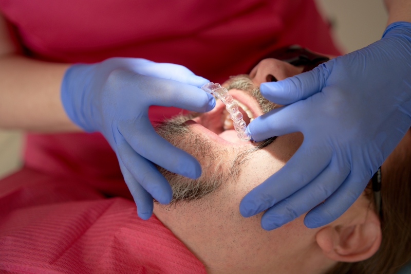 Invisalign oikomishoito lähes näkymättömin kalvoin